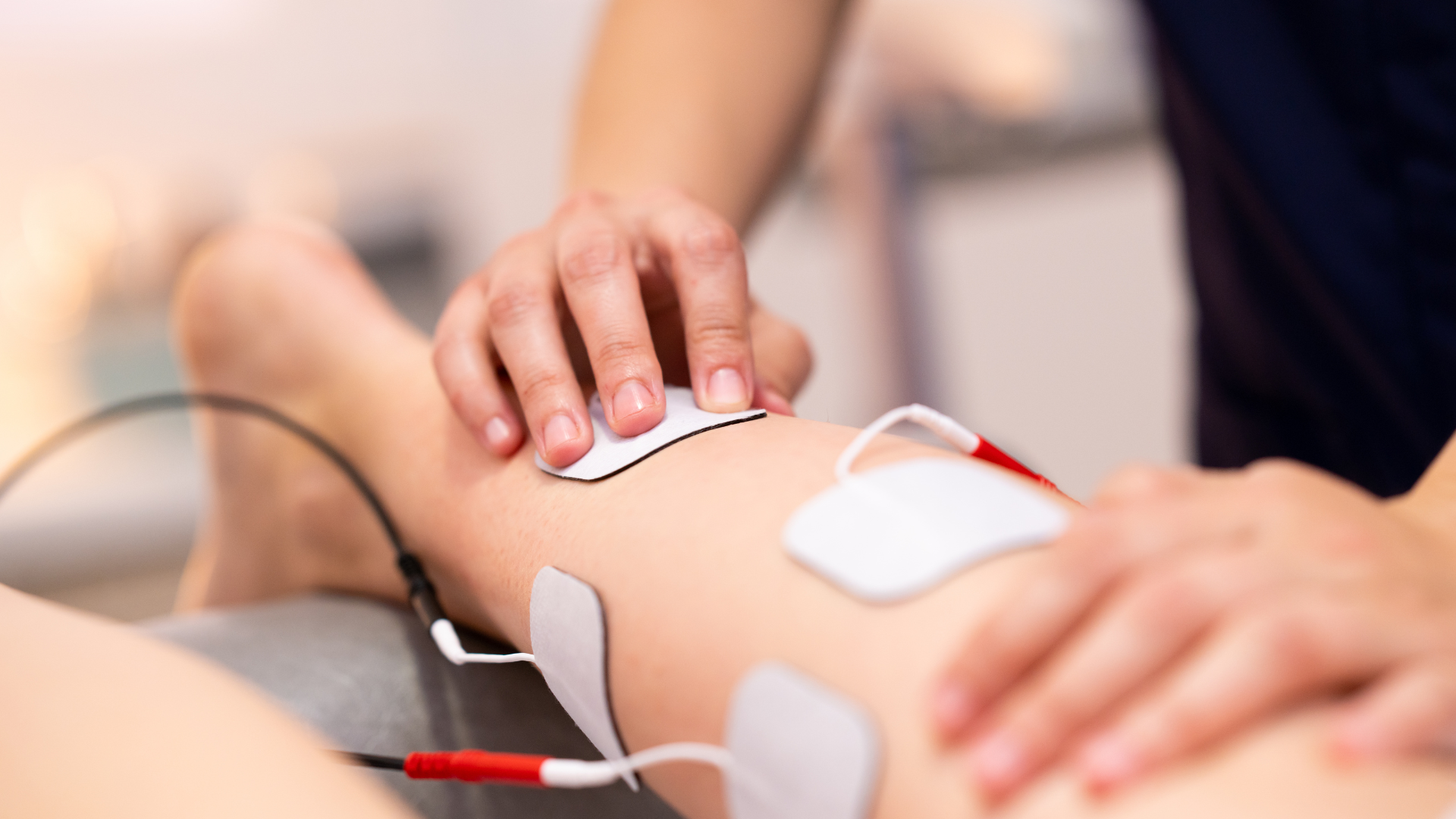 Neuromuscular Electrical Stimulation (NMES) for Rehabilitation